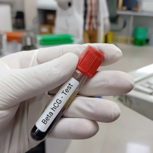 Beta HCG